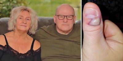 Granddad Struggles To Survive After He Gets Sepsis From Biting Fingernails Granddad Struggles To Survive After He Gets Sepsis From Biting Fingernails