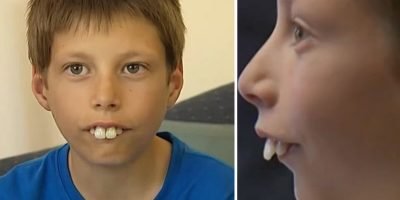 Kid bullied for his teeth problem, now has a new smile. Kid bullied for his teeth problem, now has a new smile.