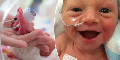 This viral photo of a premature baby smiling will brighten your day. This viral photo of a premature baby smiling will brighten your day.