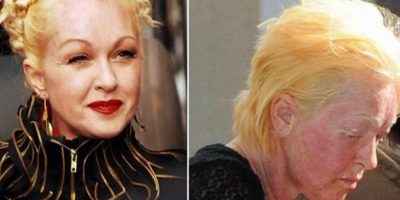 Sad news about the beloved singer Cyndi Lauper Sad news about the beloved singer Cyndi Lauper