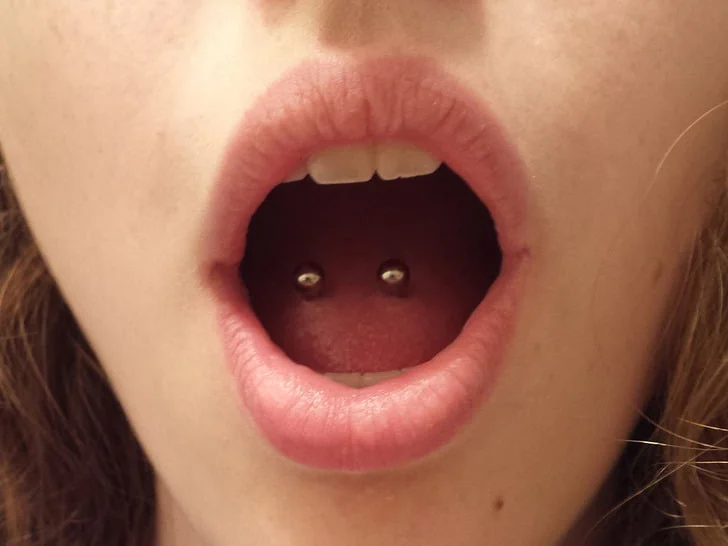 What White Tongue Is, and What to Do About It